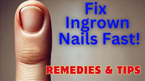 10+ Fingernail Hemorrhage Remedies For Fast Relief