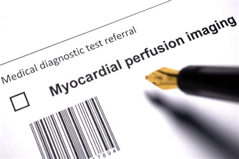10+ Myocardial Perfusion Scan Secrets For Improved Health