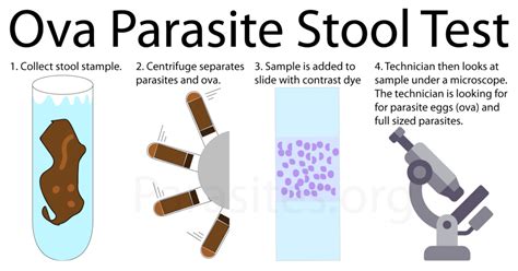 10 Stool Culture Tests For Parasite Detection