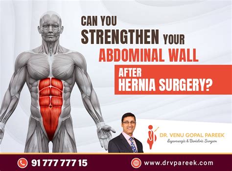 10 Umbilical Hernia Surgeries For Faster Recovery