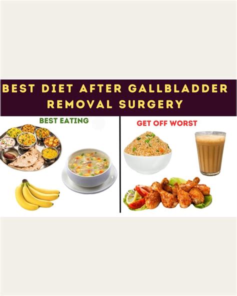10+ Ways To Reduce Recovery Time After Gallbladder Removal