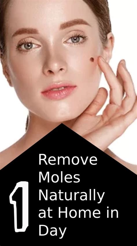 10+ Ways To Safely Remove A Mole At Home