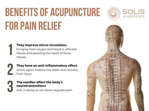 12 Acupuncture Tips For Pain Relief