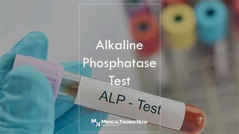 12 Alkaline Phosphatase Test Facts For Accurate Diagnosis