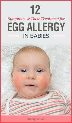12+ Allergy Symptoms To Recognize In Babies Today