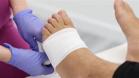 12 Bunion Surgery Recovery Tips For Faster Healing