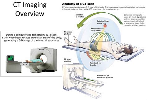 12 Cat Scan Facts That Improve Diagnosis