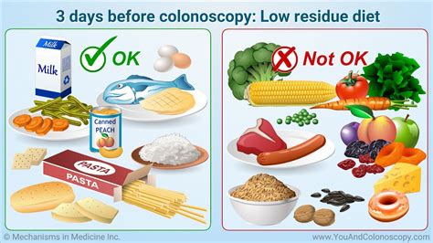 12 Food Tips Before Colonoscopy For Easy Prep