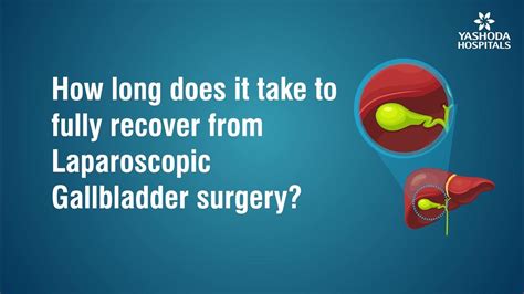 12 Gallbladder Removal Tips For Faster Recovery