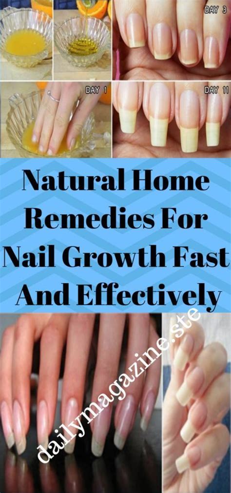 12 Nail Falling Off Remedies For Faster Healing