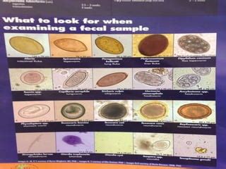 12+ Parasite Identification Methods Through Stool Culture