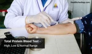 12 Protein Total Blood Test Facts For Better Health