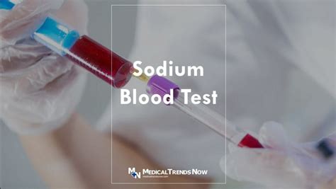 12 Sodium Blood Levels Tips For Better Health