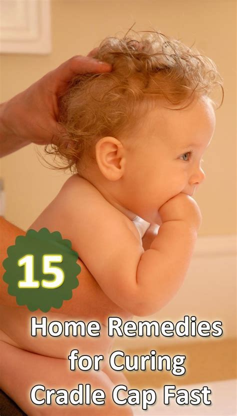 15 Home Remedies For Curing Cradle Cap Fast Some Of These Are Healthy 15 Home Remedies For Curing Cradle Cap Fast Some Of These Are Healthy