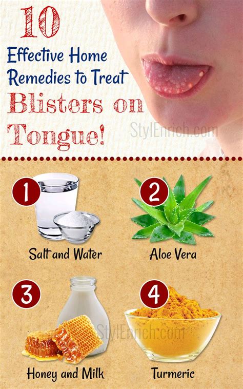 20 Home Remedies For Blisters Ideas Remedies Home Remedies Blisters