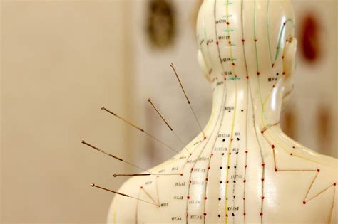 Acupuncture For What