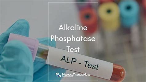 Alkaline Phosphatase Test
