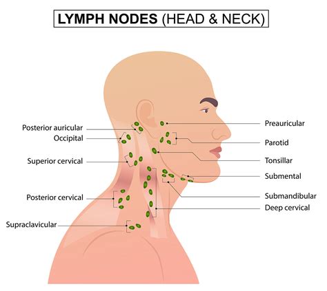 And Lymph Nodes