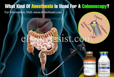 Anesthesia For Colonoscopy