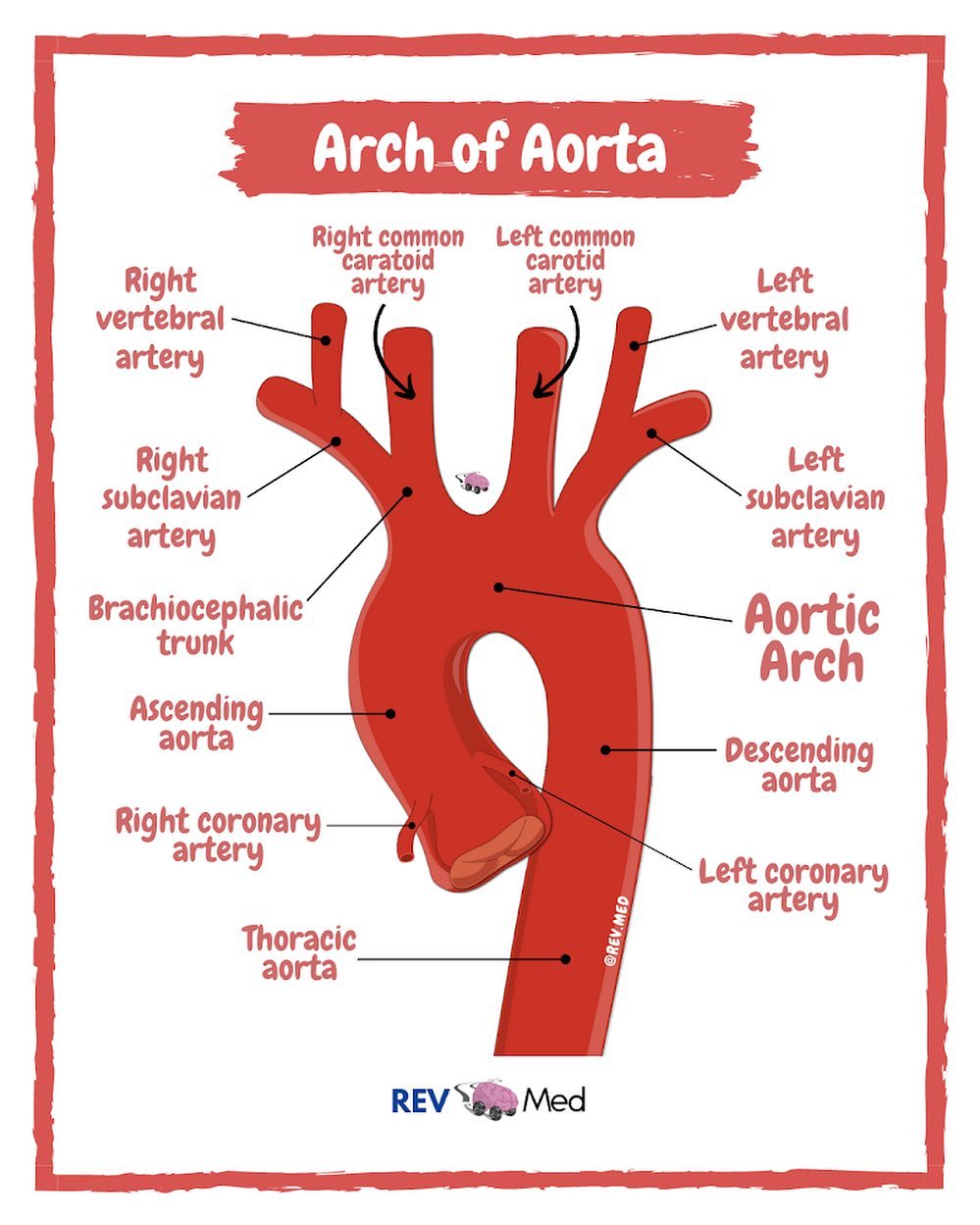 Aorta Atherosclerosis: Prevention And Treatment Options