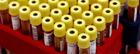 Aspartate Aminotransferase Ast Blood Test Mayo Clinic