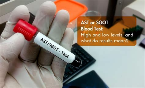 Ast Blood Test Meaning