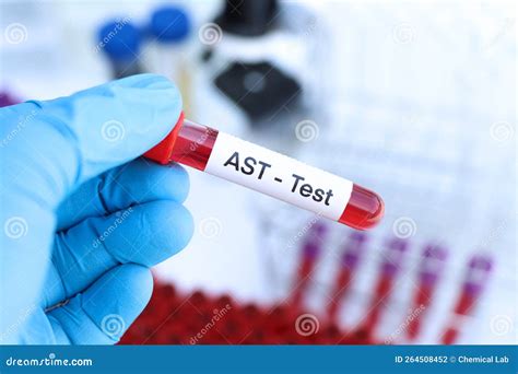 Ast Lab Test