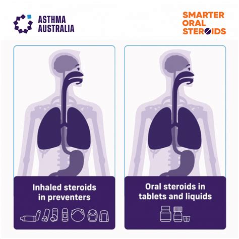 Asthma Steroids: Manage Symptoms Naturally Today