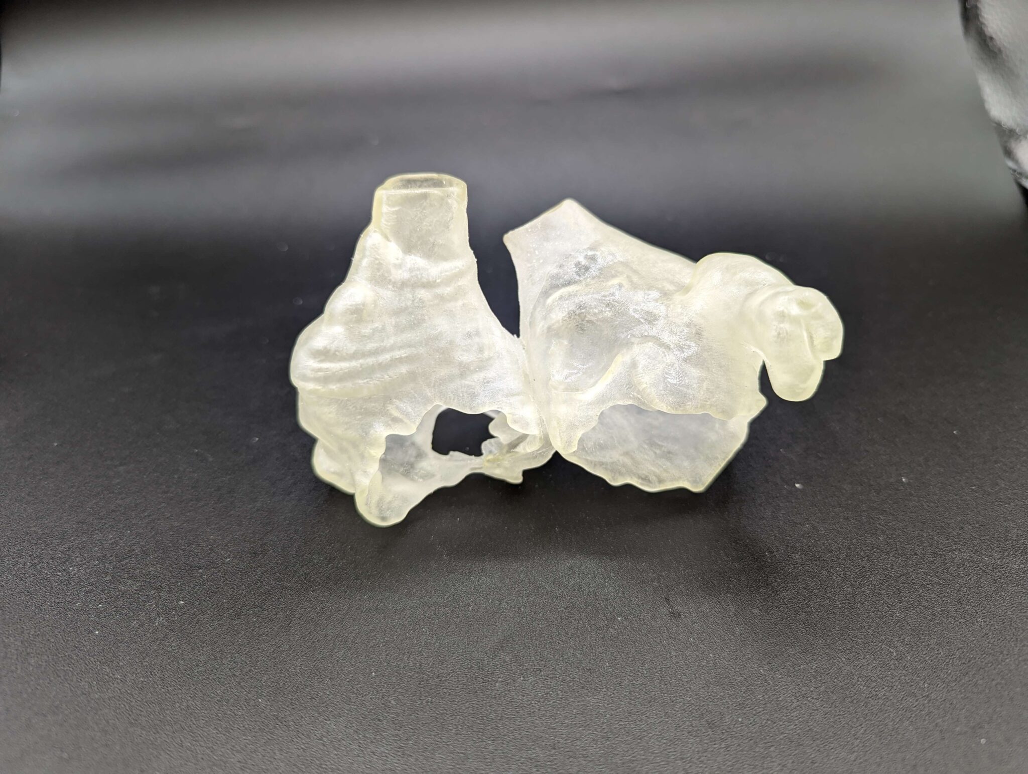 Atrial Appendage Closure