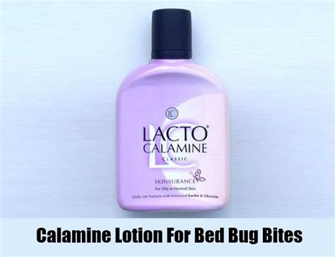 Bed Bug Bites Calamine Lotion