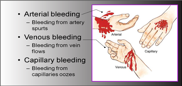 Bleeding After Iud Removal