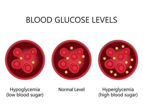 Blood Sugar Control: Reduce Risk With Normal Levels