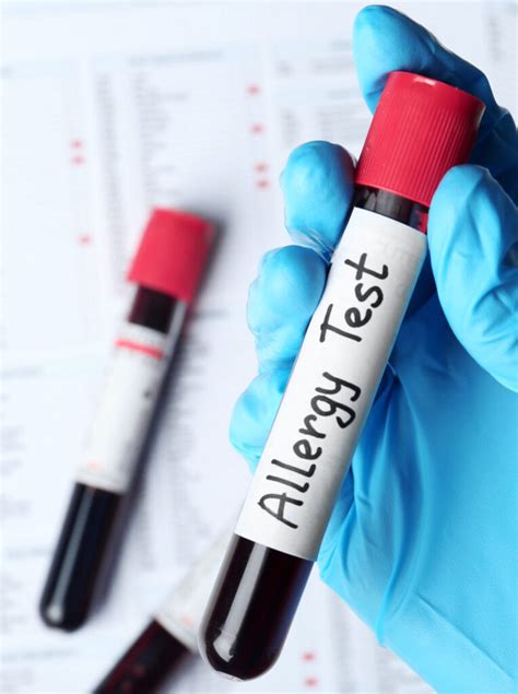 Blood Test: Diagnose Allergies Accurately
