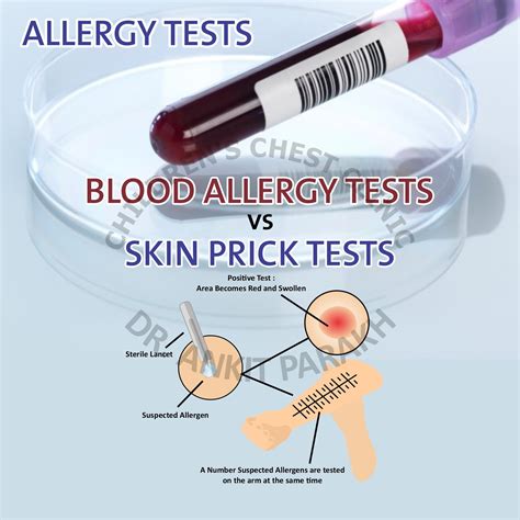 Blood Test For Allergic Reaction