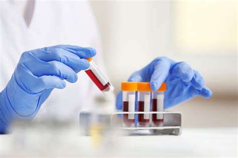 Blood Test Tests