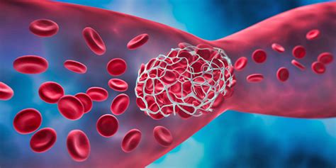 Blood Thinners Explained: Risks And Benefits