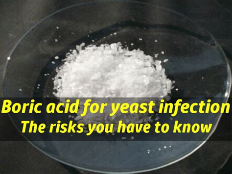 Boric Acid Yeast Infection