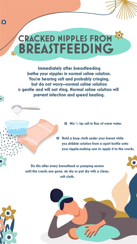 Breastfeeding With Cracked Nipples: Solutions Guide