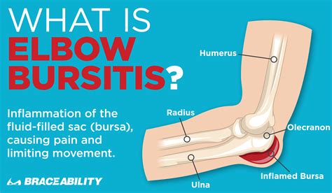 Bursitis In Elbow
