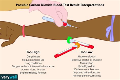 Carbon Dioxide Low Blood Test