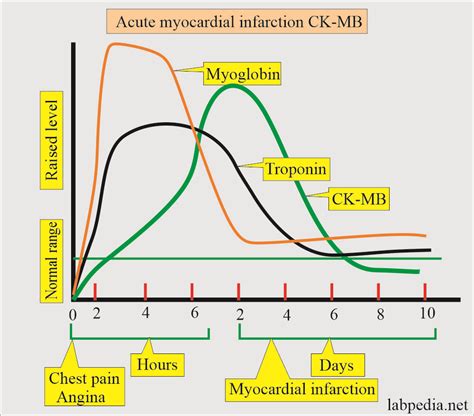 Cardiac Marker Part 2 Ck Mb Cardiac Enzyme Labpedia Net Cardiac Marker Part 2 Ck Mb Cardiac Enzyme Labpedia Net