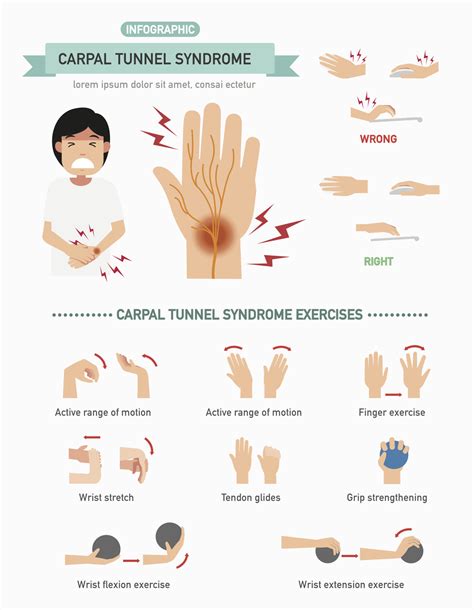 Carpal Tunnel Treatment Carpal Tunnel Treatment