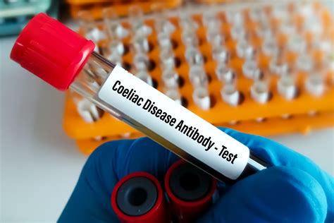 Celiac Disease Blood Test: Identify Gluten Intolerance