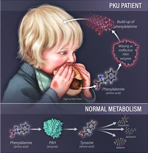 Chance To Get Pku