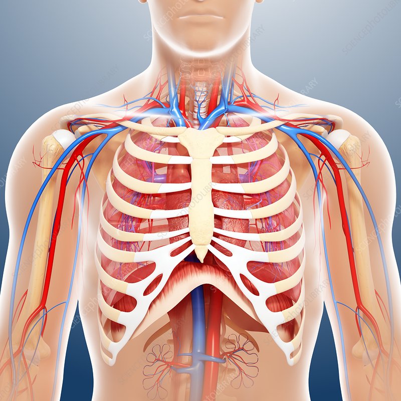 Chest Catheter For Dialysis