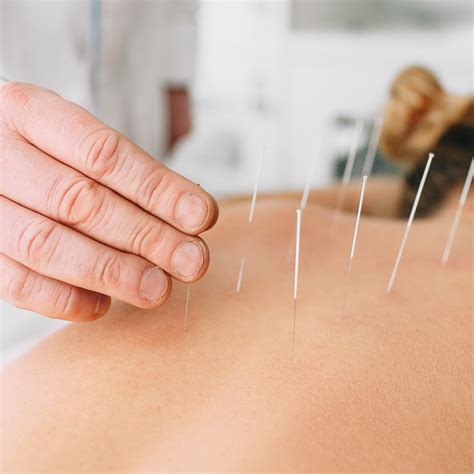 Chinese Acupuncturist Near Me