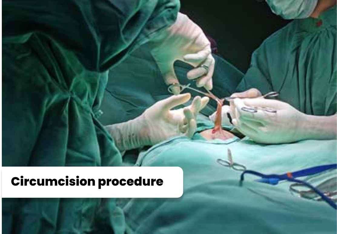 Circumcision Care Newborn