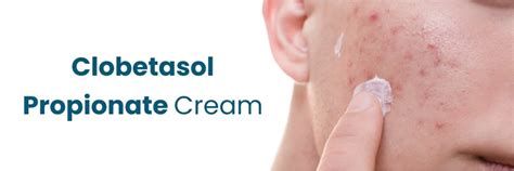 Clobetasol Cream Uses Drbeckmann