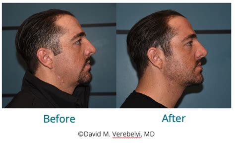 Colorado Skin Health: Comprehensive Treatment Options