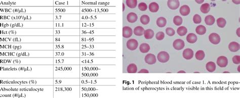 Complete Blood Count And Reticulocyte Count Of Case 1 Download Table
